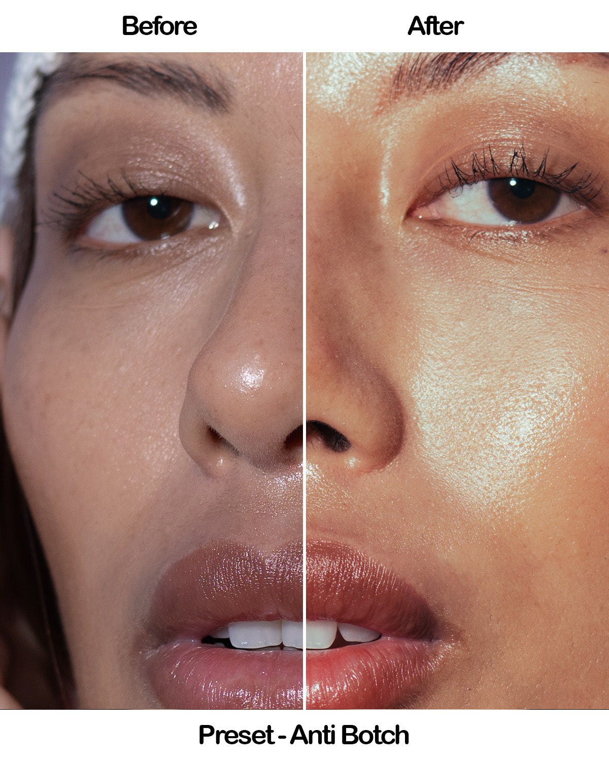 SKIN – Mini Lightroom Preset Pack