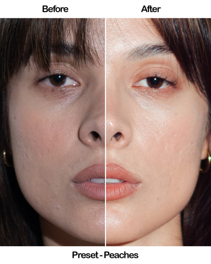 SKIN – Mini Lightroom Preset Pack